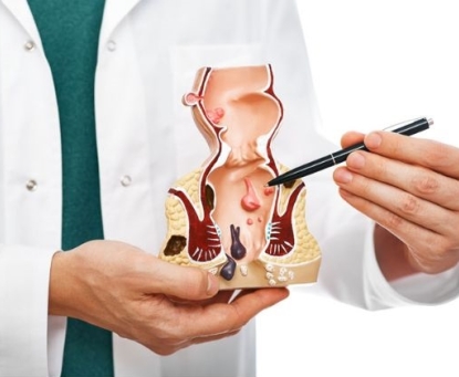 Bệnh trĩ có cần phẫu thuật không?